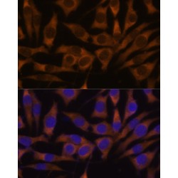 Insulin Like Growth Factor 2 mRNA Binding Protein 3 (IGF2BP3) Antibody