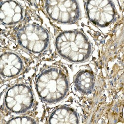 Neurogenin 3 (NEUROG3) Antibody
