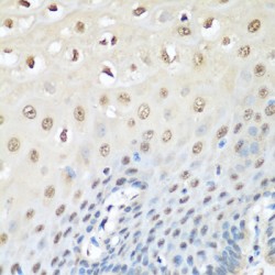 Transitional Endoplasmic Reticulum ATPase (VCP) Antibody