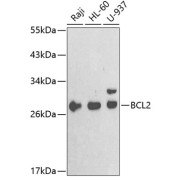 Western blot analysis of extracts of various cell lines using Bcl-2 Antibody (1/1000 dilution).
