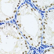Immunohistochemistry of paraffin-embedded Rat testis using DDB1 Antibody (1/100 dilution, 40x lens).