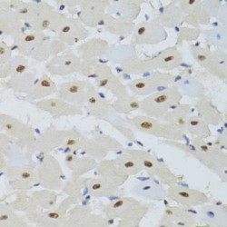 DNA Damage-Binding Protein 1 (DDB1) Antibody
