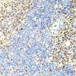 Eukaryotic Translation Initiation Factor 4 Gamma 2 (EIF4G2) Antibody
