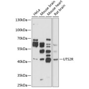 Western blot analysis of extracts of various cell lines using UTS2R Antibody (1/1000 dilution).