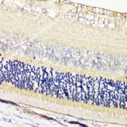 abx002158