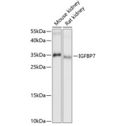 abx002169