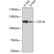 Western blot analysis of extracts of various cell lines using CSF1R Antibody (1/50 dilution)0.