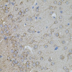 Matrix Metalloproteinase 10 (MMP10) Antibody