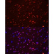 Immunofluorescence analysis of Rat brain using GRIN2B Antibody (1/100 dilution). Blue: DAPI for nuclear staining.