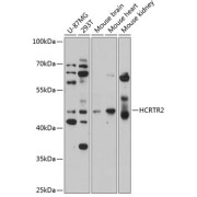 Western blot analysis of extracts of various cell lines using HCRTR2 Antibody (1/1000 dilution).