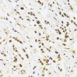 RAD50 Double Strand Break Repair Protein (RAD50) Antibody