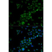 abx002224