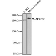 Western blot analysis of extracts of various cell lines using NFATC2 Antibody (1/50 dilution)0.