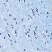 Immunohistochemistry of paraffin-embedded Rat brain using NFkB p100 / p52 Antibody (1/100 dilution, 40x lens).