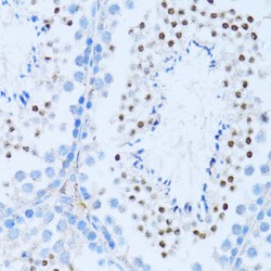 Nuclear Factor NF-Kappa-B P100 Subunit (NFKB2) Antibody