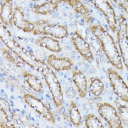 Immunohistochemistry of paraffin-embedded Rat kidney using PPP2CB Antibody (1/100 dilution, 40x lens).