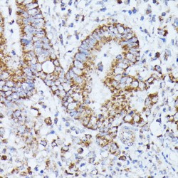 Protein Phosphatase 2 Catalytic Subunit Beta (PPP2CB) Antibody