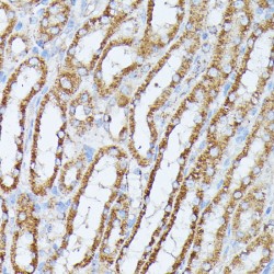 Protein Phosphatase 2 Catalytic Subunit Beta (PPP2CB) Antibody