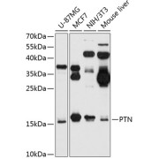 Western blot analysis of extracts of various cell lines using PTN Antibody (1/1000 dilution).