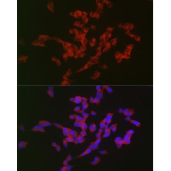 Amyloid-beta Precursor Protein (APP) Antibody