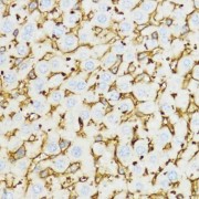 Immunohistochemistry of paraffin-embedded Mouse liver using YKL-40 / CHI3L1 Antibody (1/100 dilution, 40x lens).