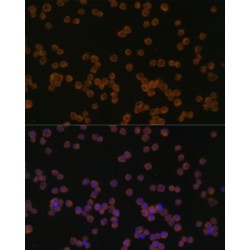 Chitinase-3-Like Protein 1 (CHI3L1) Antibody