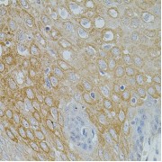 Immunohistochemistry of paraffin-embedded Human esophagus using NTF3 Antibody (1/100 dilution, 40x lens).