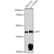 Western blot analysis of extracts of various cell lines using p53 Antibody (1/1000 dilution).