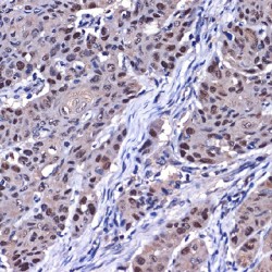 Cellular Tumor Antigen P53 (TP53) Antibody