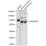 Western blot analysis of extracts of various cell lines using CDKN2AIP Antibody (1/1000 dilution).