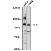 Western blot analysis of extracts of various cell line using HHIP Antibody (1/3000 dilution).