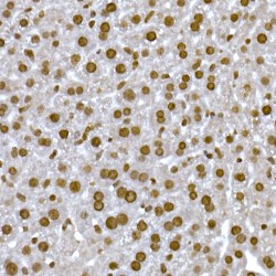 Histone Cluster 1 H1 Family Member C (HIST1H1C) Antibody