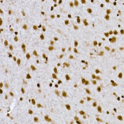 Histone Cluster 1 H1 Family Member C (HIST1H1C) Antibody