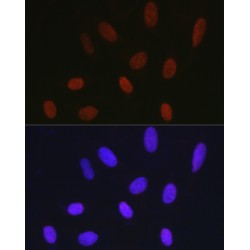 Histone Cluster 1 H1 Family Member C (HIST1H1C) Antibody