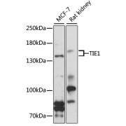 Western blot analysis of extracts of various cell lines using TIE1 Antibody (1/1000 dilution).