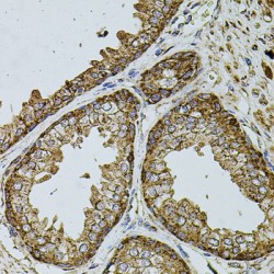 Cytochrome B-C1 Complex Subunit 1, Mitochondrial (UQCRC1) Antibody