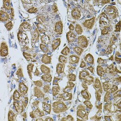 Cytochrome B-C1 Complex Subunit 1, Mitochondrial (UQCRC1) Antibody