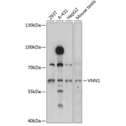 Western blot analysis of extracts of various cell lines using VNN1 Antibody (1/3000 dilution).