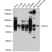 Western blot analysis of extracts of various cell lines using POLA2 Antibody (1/1000 dilution).