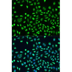 Staufen Double-Stranded RNA Binding Protein 2 (STAU2) Antibody