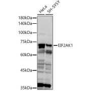Western blot analysis of various lysates using EIF2AK1 Antibody (1/1000 dilution).