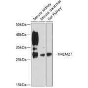 Western blot analysis of extracts of various cell lines using TMEM27 Antibody (1/3000 dilution).