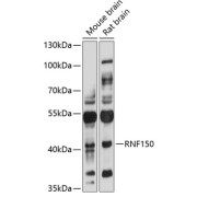 Western blot analysis of extracts of various cell lines using RNF150 Antibody (1/3000 dilution).