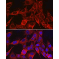 Chondroitin Sulfate Proteoglycan 4 (CSPG4) Antibody