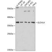 Western blot analysis of extracts of various cell lines using ELOVL4 Antibody (1/3000 dilution).