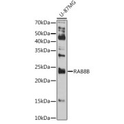 Western blot analysis of extracts of U-87MG cells using RAB8B Antibody (1/500 dilution).