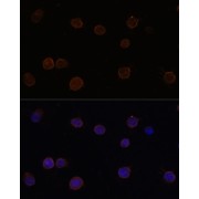 Immunofluorescence analysis of Y79 cells using ANO2 Antibody (1/100 dilution, 40x lens). Blue: DAPI for nuclear staining.