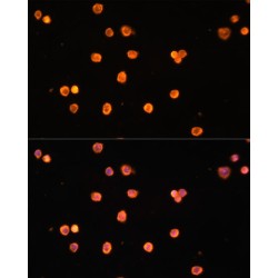 Ectonucleoside Triphosphate Diphosphohydrolase 1 (ENTPD1) Antibody
