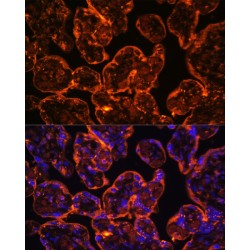 Ectonucleoside Triphosphate Diphosphohydrolase 1 (ENTPD1) Antibody