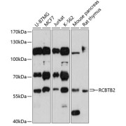 Western blot analysis of extracts of various cell lines using RCBTB2 Antibody (1/3000 dilution).